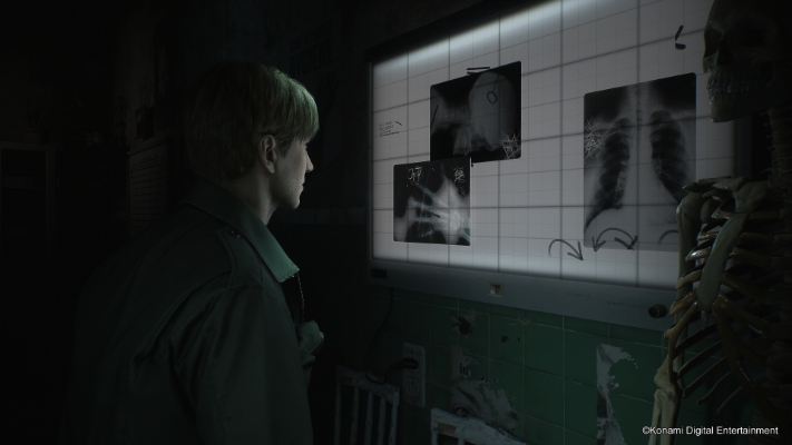  Obraz SILENT HILL 2 - Deluxe Edition